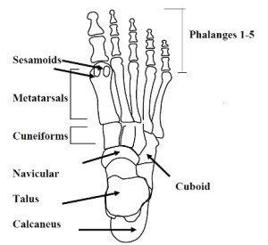 Edina Foot Fracture Surgery - Silverman Ankle & Foot - Twin Cities Foot ...