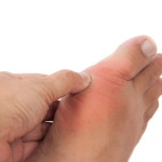 Toe Sprain