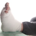 Diabetic Foot in Edina