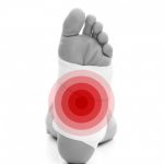 Misconceptions about foot injuries