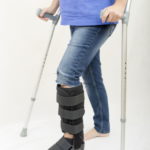 Ankle fracture Casting Study Minnesota