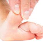 soft hammertoe