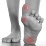 heel pain plantar fasciitis