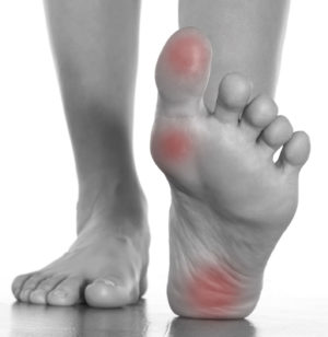 heel pain plantar fasciitis