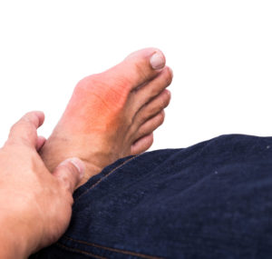 big toe arthritis causes