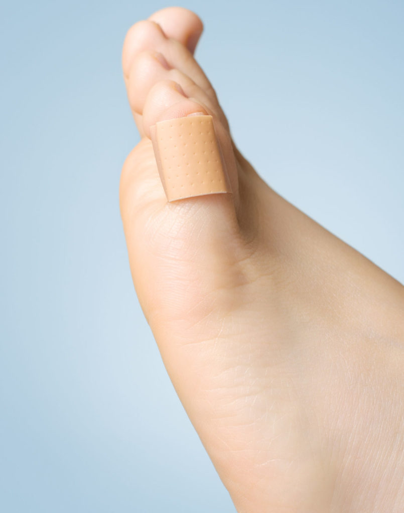 95908729 Closeup Of A Plaster On Female Toe Silverman Ankle And Foot Edina Orthopedic Surgeon
