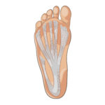 plantar fascia tear