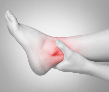 The Different Types Of Ankle Arthritis | Silverman Ankle and Foot