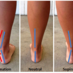 ankle pronation